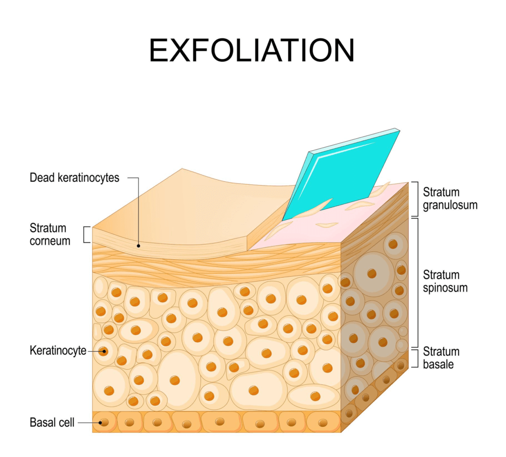 Skin exfoliation treatment